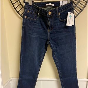 STS Blue Ankle Skinny Jeans